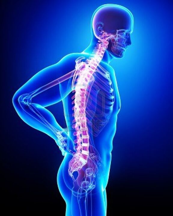 Osteokondrozdan etkilenen insan omurgası